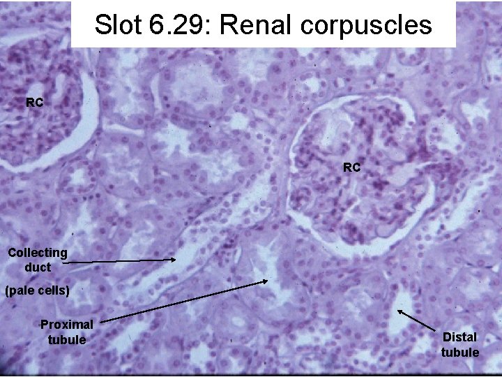 Slot 6. 29: Renal corpuscles RC RC Collecting duct (pale cells) Proximal tubule Distal
