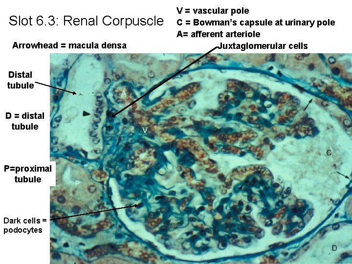 Slot 6. 3: Renal Corpuscle Arrowhead = macula densa Distal tubule D = distal