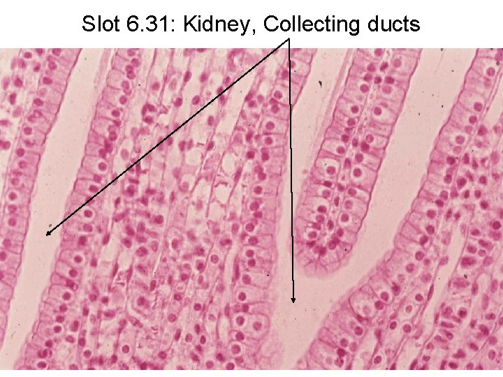 Slot 6. 31: Kidney, Collecting ducts 