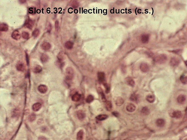 Slot 6. 32: Collecting ducts (c. s. ) 