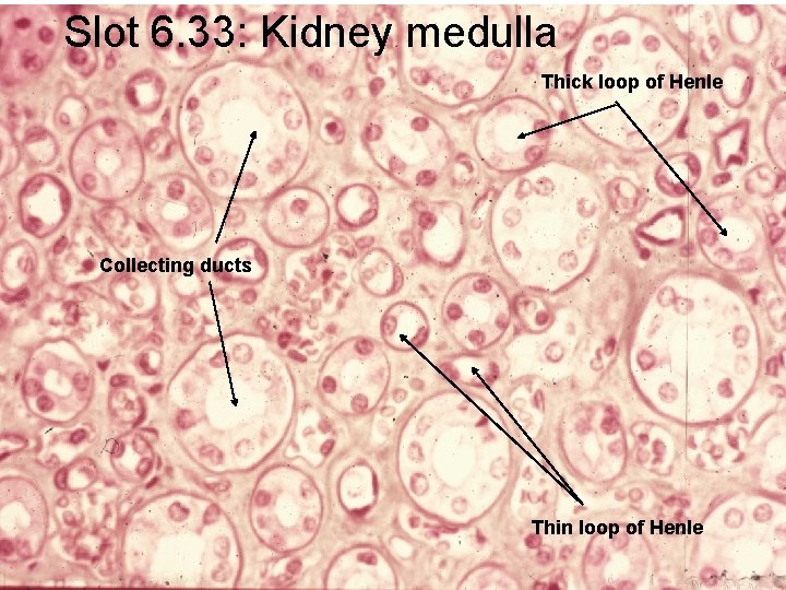 Slot 6. 33: Kidney medulla Thick loop of Henle Collecting ducts Thin loop of