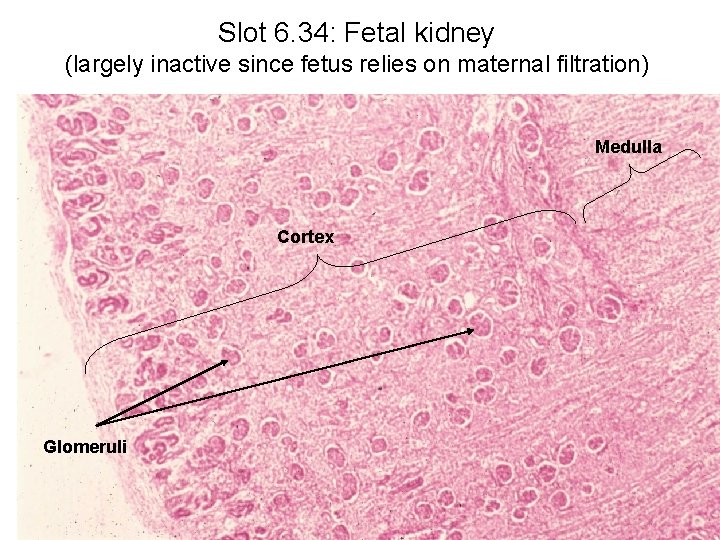 Slot 6. 34: Fetal kidney (largely inactive since fetus relies on maternal filtration) Medulla