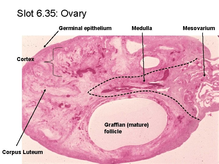 Slot 6. 35: Ovary Germinal epithelium Medulla Cortex Graffian (mature) follicle Corpus Luteum Mesovarium