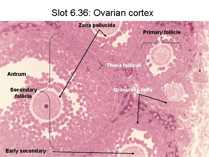 Slot 6. 36: Ovarian cortex Zona pellucida Primary follicle Theca folliculi Antrum Secondary follicle