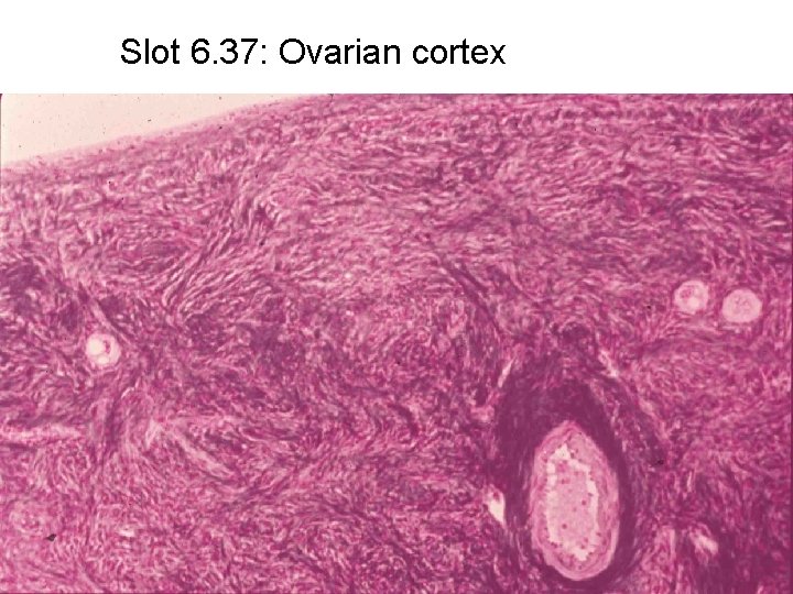 Slot 6. 37: Ovarian cortex 