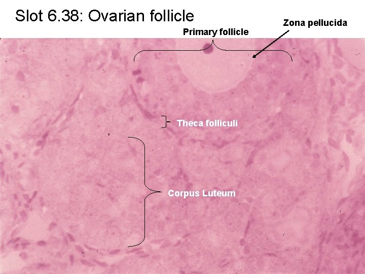 Slot 6. 38: Ovarian follicle Primary follicle Theca folliculi Corpus Luteum Zona pellucida 
