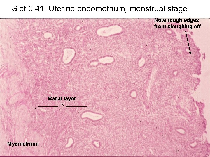 Slot 6. 41: Uterine endometrium, menstrual stage Note rough edges from sloughing off Basal