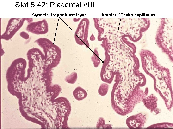 Slot 6. 42: Placental villi Syncitial trophoblast layer Areolar CT with capillaries 