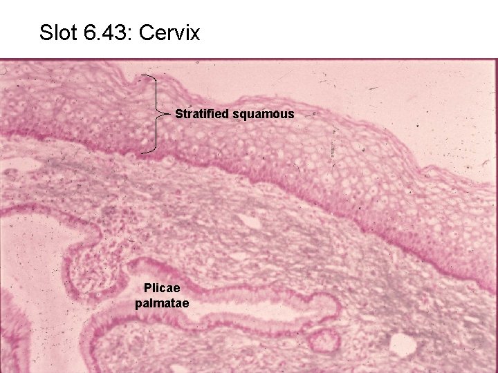 Slot 6. 43: Cervix Stratified squamous Plicae palmatae 