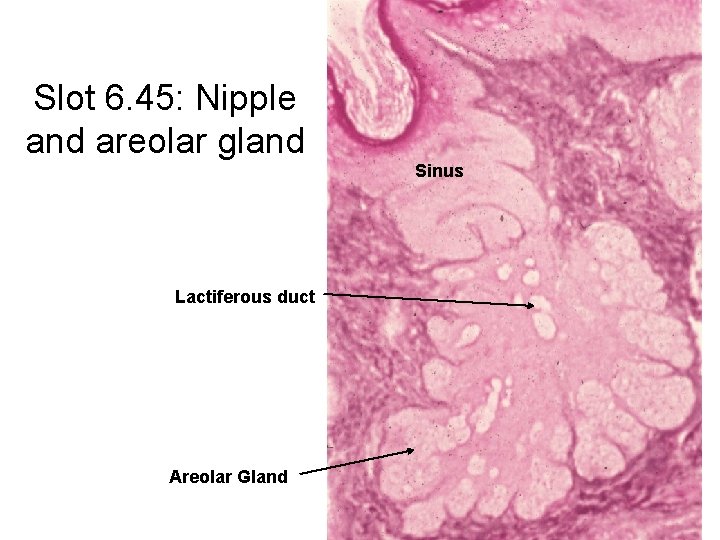 Slot 6. 45: Nipple and areolar gland Sinus Lactiferous duct Areolar Gland 