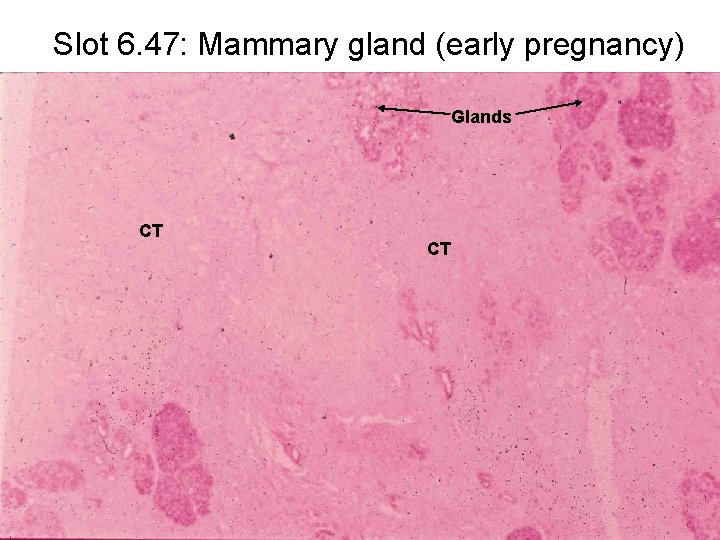 Slot 6. 47: Mammary gland (early pregnancy) Glands CT CT 