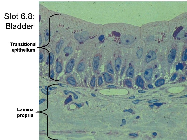 Slot 6. 8: Bladder Transitional epithelium Lamina propria 