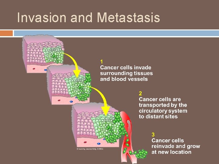 Invasion and Metastasis 