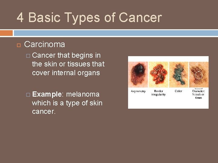 4 Basic Types of Cancer Carcinoma � Cancer that begins in the skin or