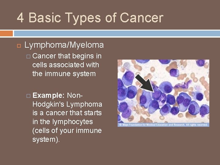 4 Basic Types of Cancer Lymphoma/Myeloma � Cancer that begins in cells associated with