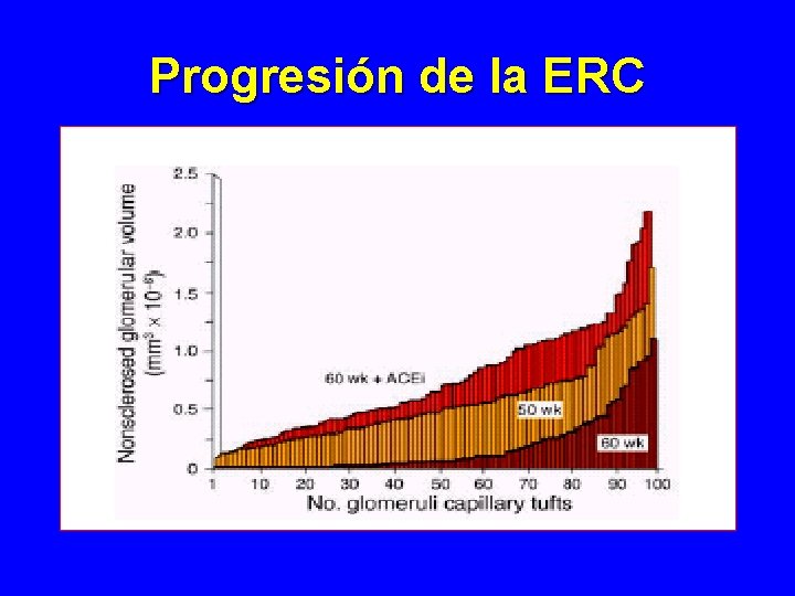 Progresión de la ERC Progresión de la ERC