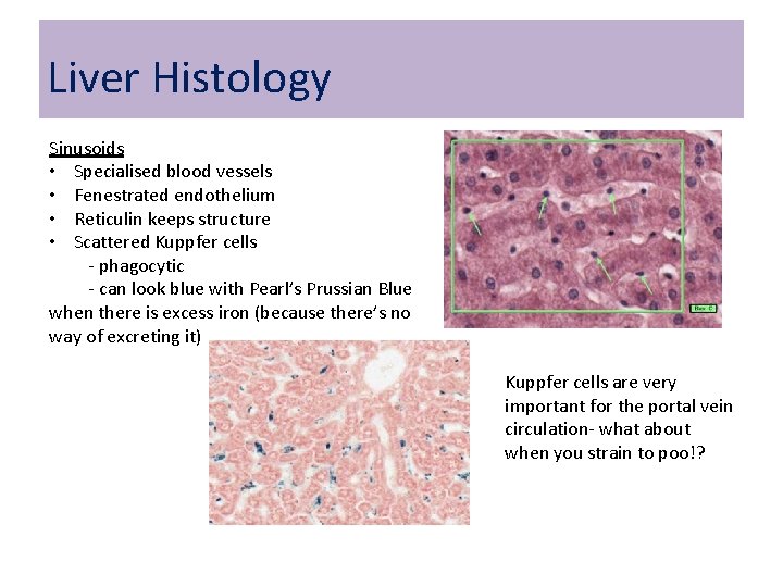 Liver Histology Sinusoids • Specialised blood vessels • Fenestrated endothelium • Reticulin keeps structure Liver Histology Sinusoids • Specialised blood vessels • Fenestrated endothelium • Reticulin keeps structure