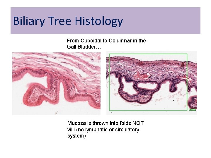 Biliary Tree Histology From Cuboidal to Columnar in the Gall Bladder… Mucosa is thrown Biliary Tree Histology From Cuboidal to Columnar in the Gall Bladder… Mucosa is thrown