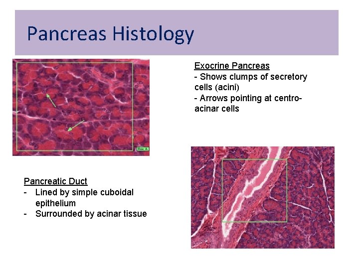 Pancreas Histology Exocrine Pancreas - Shows clumps of secretory cells (acini) - Arrows pointing Pancreas Histology Exocrine Pancreas - Shows clumps of secretory cells (acini) - Arrows pointing