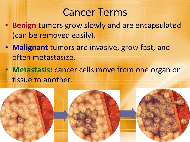 Cancer Terms • Benign tumors grow slowly and are encapsulated (can be removed easily).