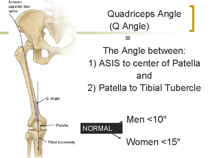 Quadriceps Angle (Q Angle) = The Angle between: 1) ASIS to center of Patella