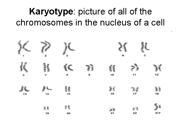 Karyotype: picture of all of the chromosomes in the nucleus of a cell 