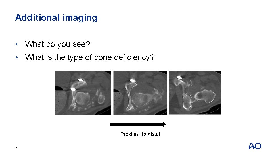 Additional imaging • What do you see? • What is the type of bone
