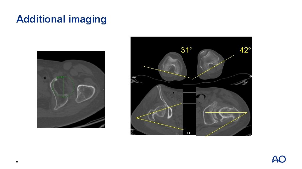 Additional imaging 31° 8 42° 