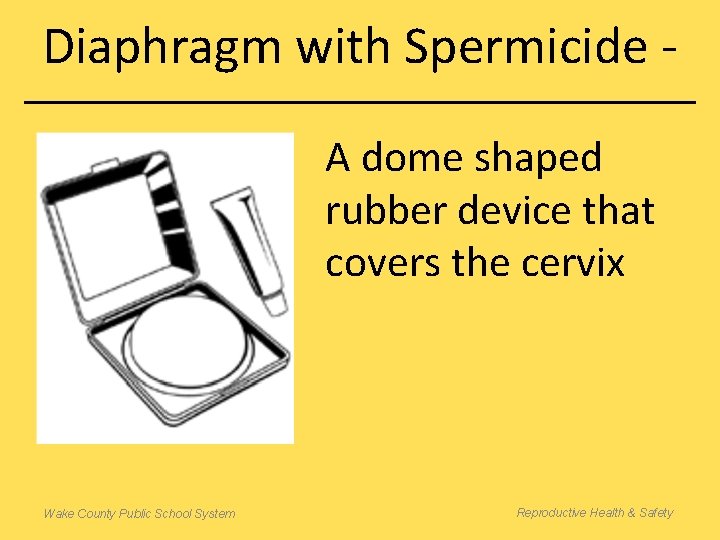 Diaphragm with Spermicide A dome shaped rubber device that covers the cervix Wake County