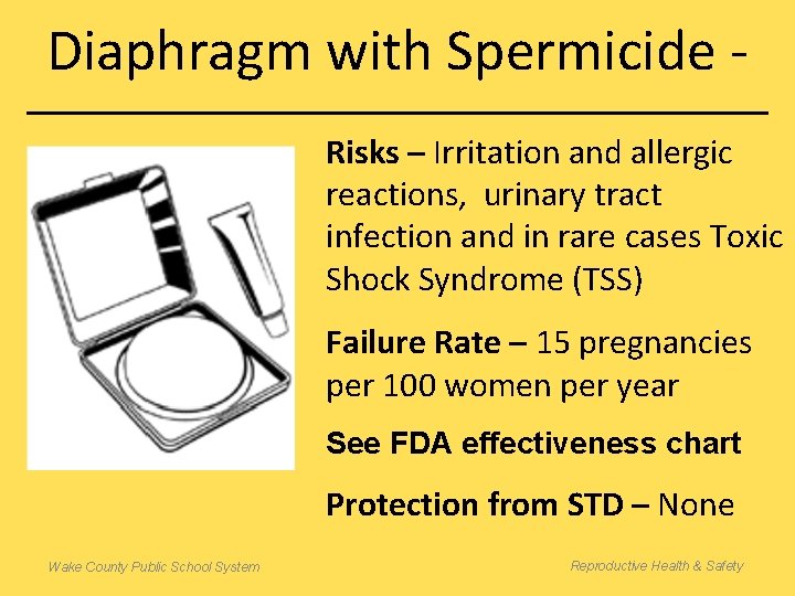 Diaphragm with Spermicide Risks – Irritation and allergic reactions, urinary tract infection and in