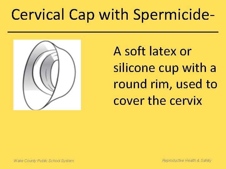 Cervical Cap with Spermicide. A soft latex or silicone cup with a round rim,