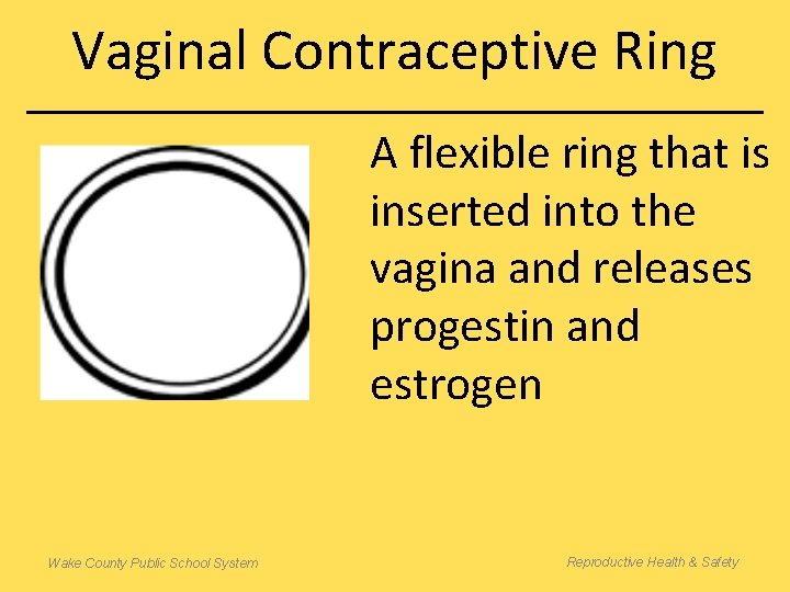 Vaginal Contraceptive Ring A flexible ring that is inserted into the vagina and releases