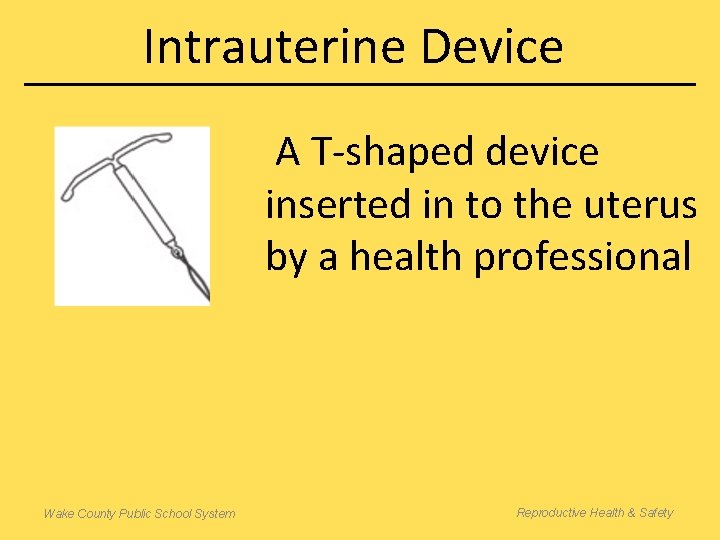 Intrauterine Device A T-shaped device inserted in to the uterus by a health professional