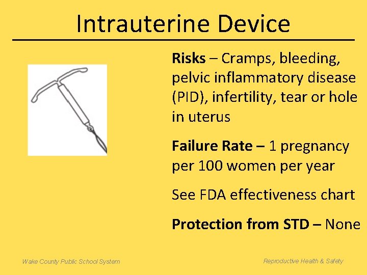 Intrauterine Device Risks – Cramps, bleeding, pelvic inflammatory disease (PID), infertility, tear or hole