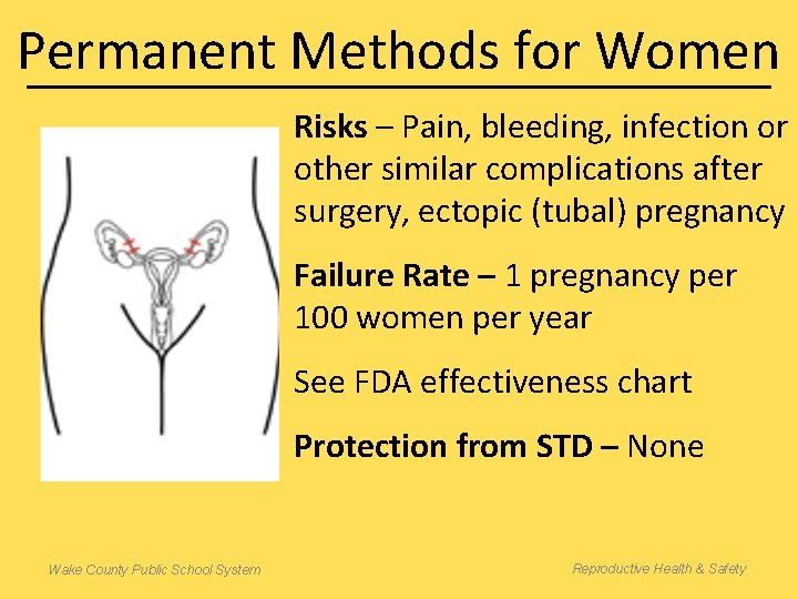 Permanent Methods for Women Risks – Pain, bleeding, infection or other similar complications after