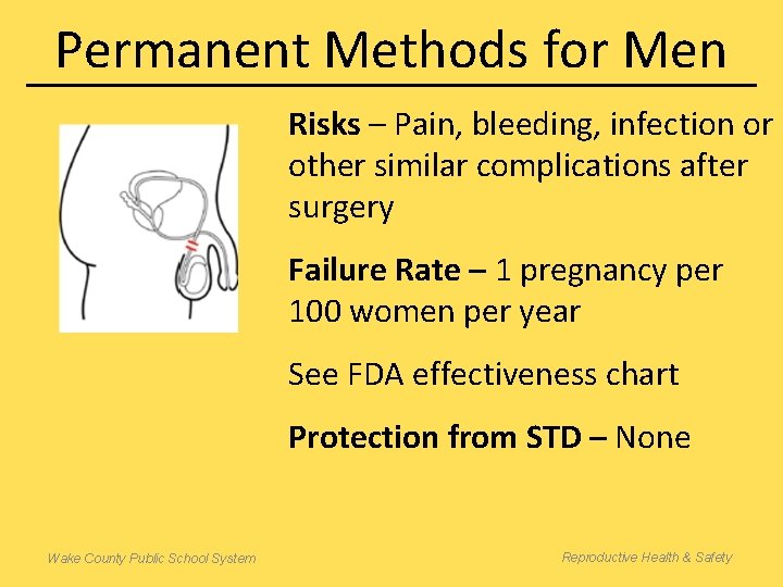 Permanent Methods for Men Risks – Pain, bleeding, infection or other similar complications after