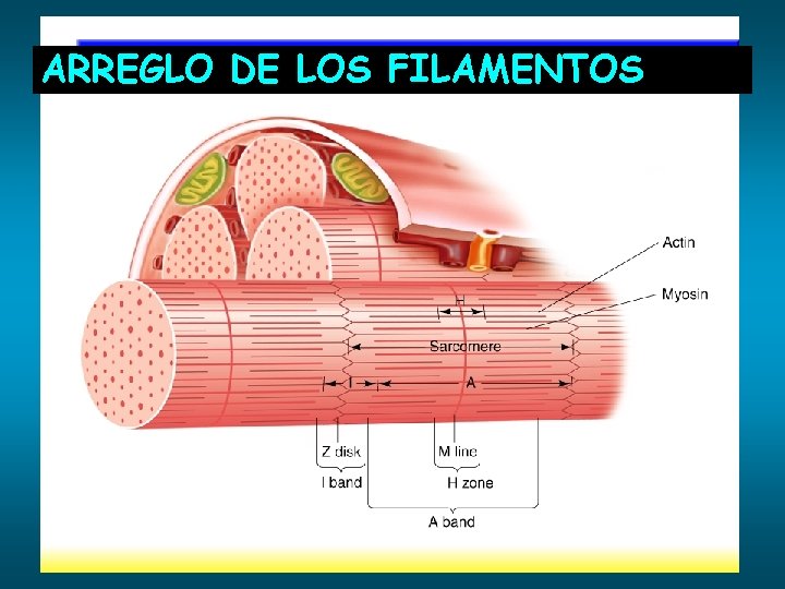 ARREGLO DE LOS FILAMENTOS 