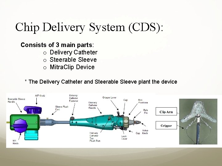 Chip Delivery System (CDS): Consists of 3 main parts: o Delivery Catheter o Steerable