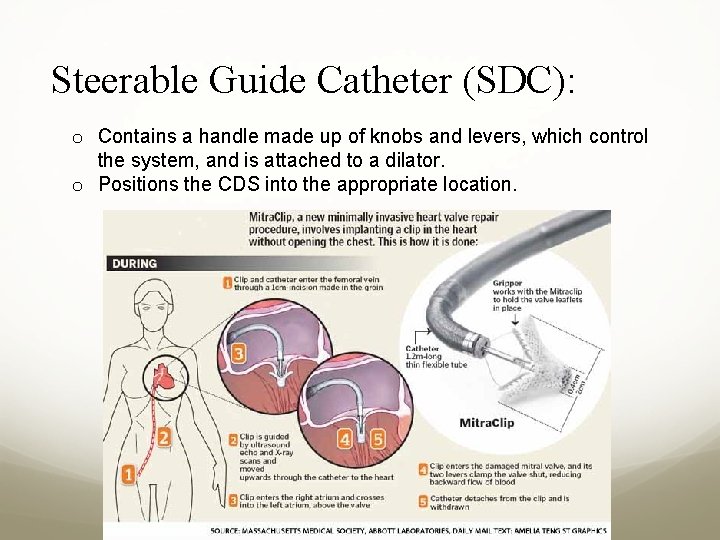 Steerable Guide Catheter (SDC): o Contains a handle made up of knobs and levers,