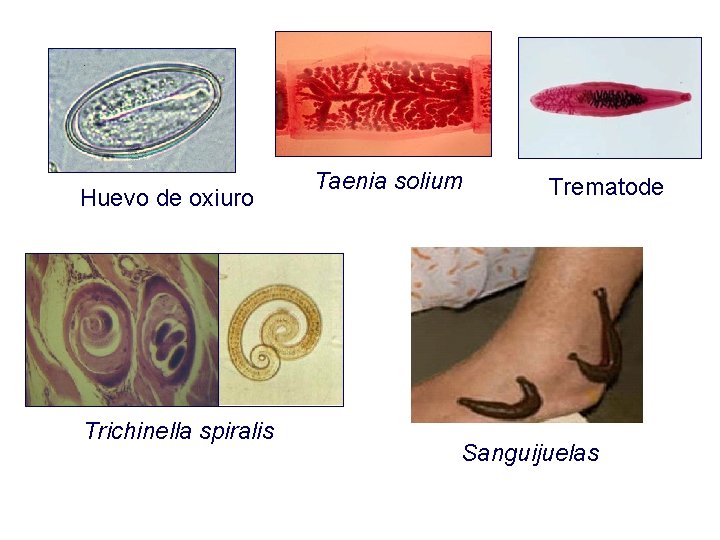 Huevo de oxiuro Trichinella spiralis Taenia solium Trematode Sanguijuelas 