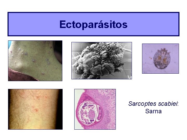 Ectoparásitos Sarcoptes scabiei: Sarna 