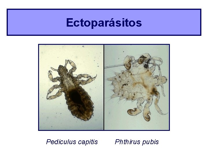 Ectoparásitos Pediculus capitis Phthirus pubis 
