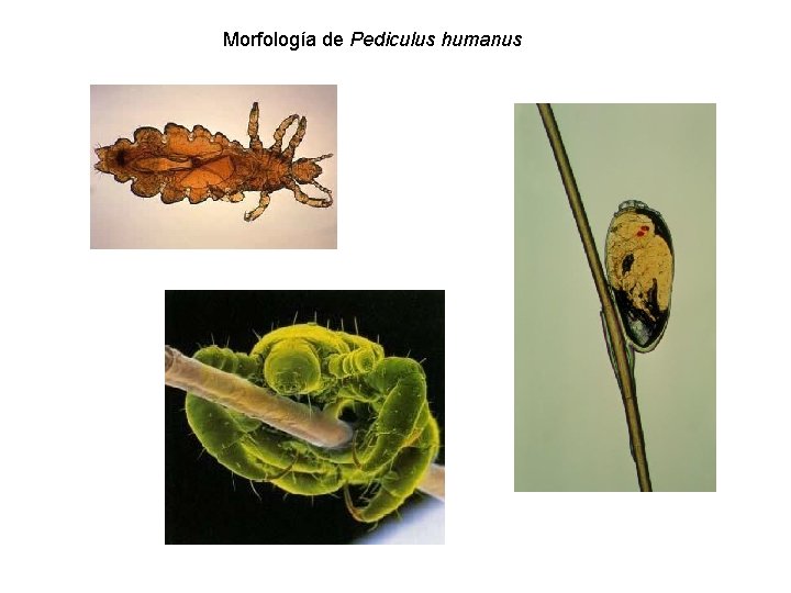 Morfología de Pediculus humanus 