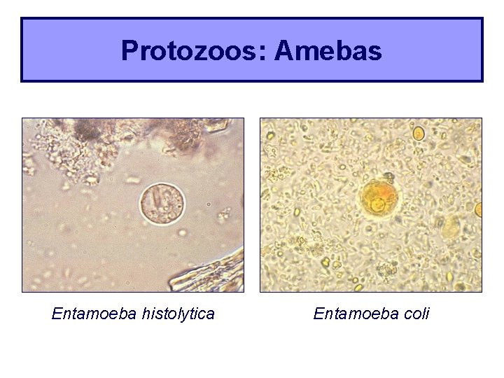 Protozoos: Amebas Entamoeba histolytica Entamoeba coli 