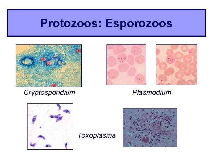 Protozoos: Esporozoos Cryptosporidium Plasmodium Toxoplasma 