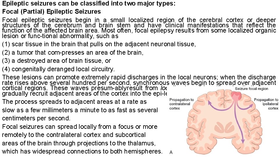 Epileptic seizures can be classified into two major types: Focal (Partial) Epileptic Seizures Focal