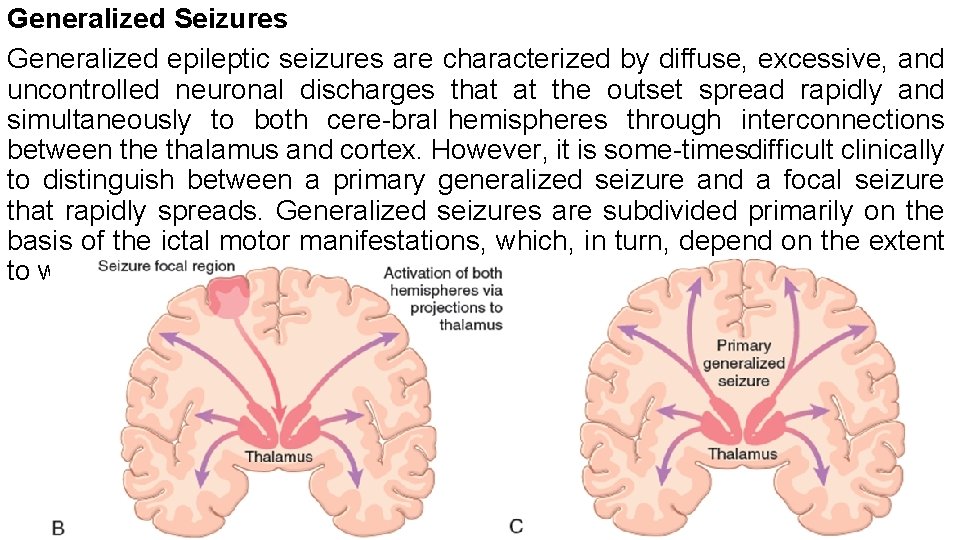 Generalized Seizures Generalized epileptic seizures are characterized by diffuse, excessive, and uncontrolled neuronal discharges