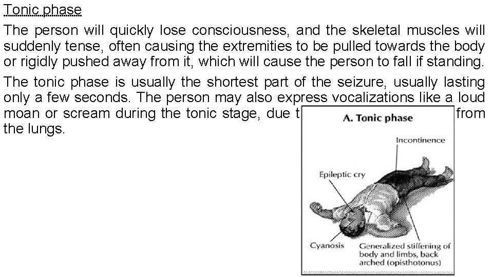 Tonic phase The person will quickly lose consciousness, and the skeletal muscles will suddenly