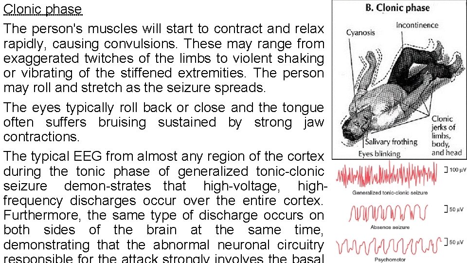 Clonic phase The person's muscles will start to contract and relax rapidly, causing convulsions.