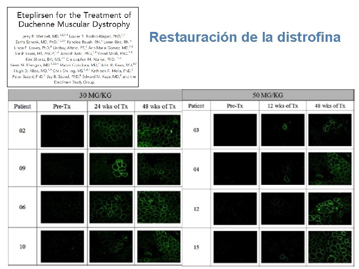 Restauración de la distrofina 